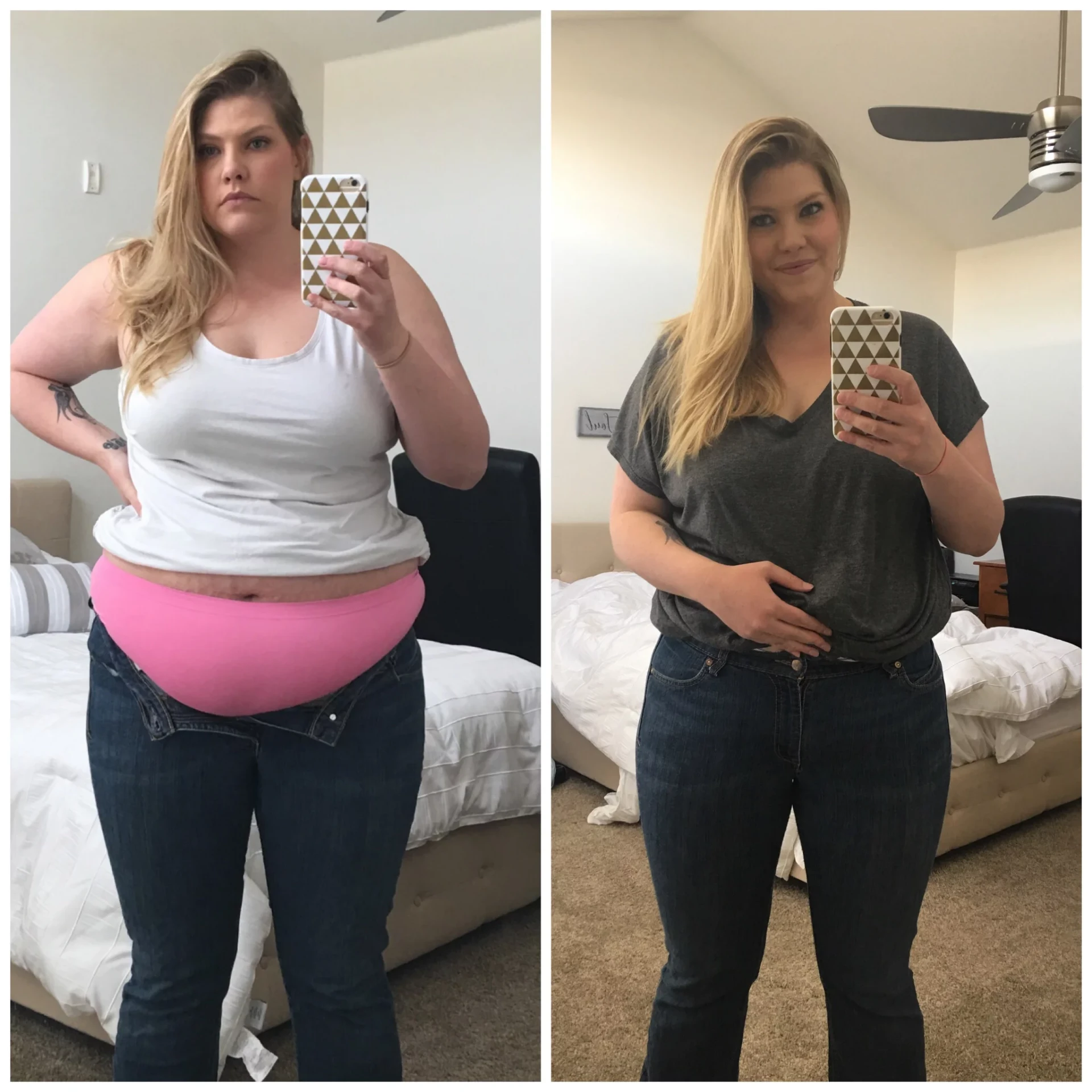NEXA Retatrutide before and after weight loss result 4 (-18 kg · 90 days)