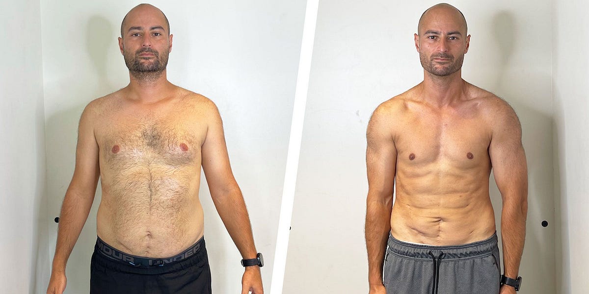 NEXA Retatrutide before and after weight loss result 3 (-20 kg · 100 days)