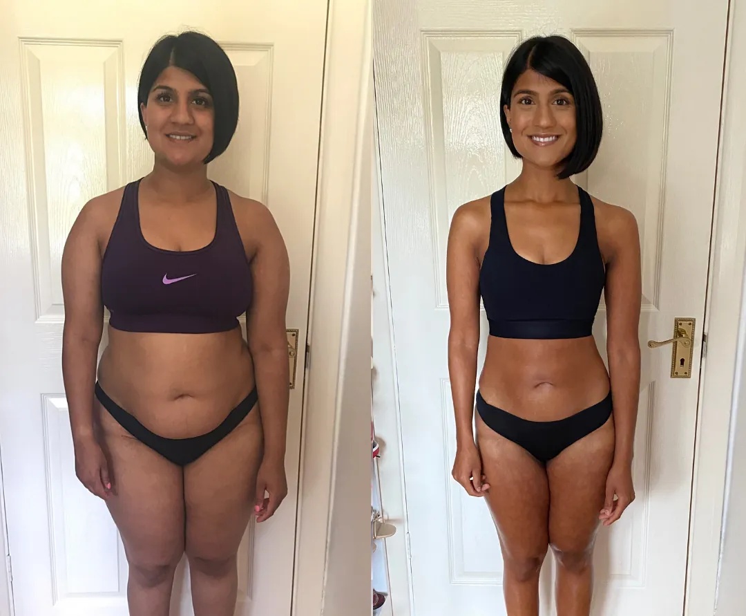 NEXA Retatrutide before and after weight loss result 2 (-17 kg · 120 days)