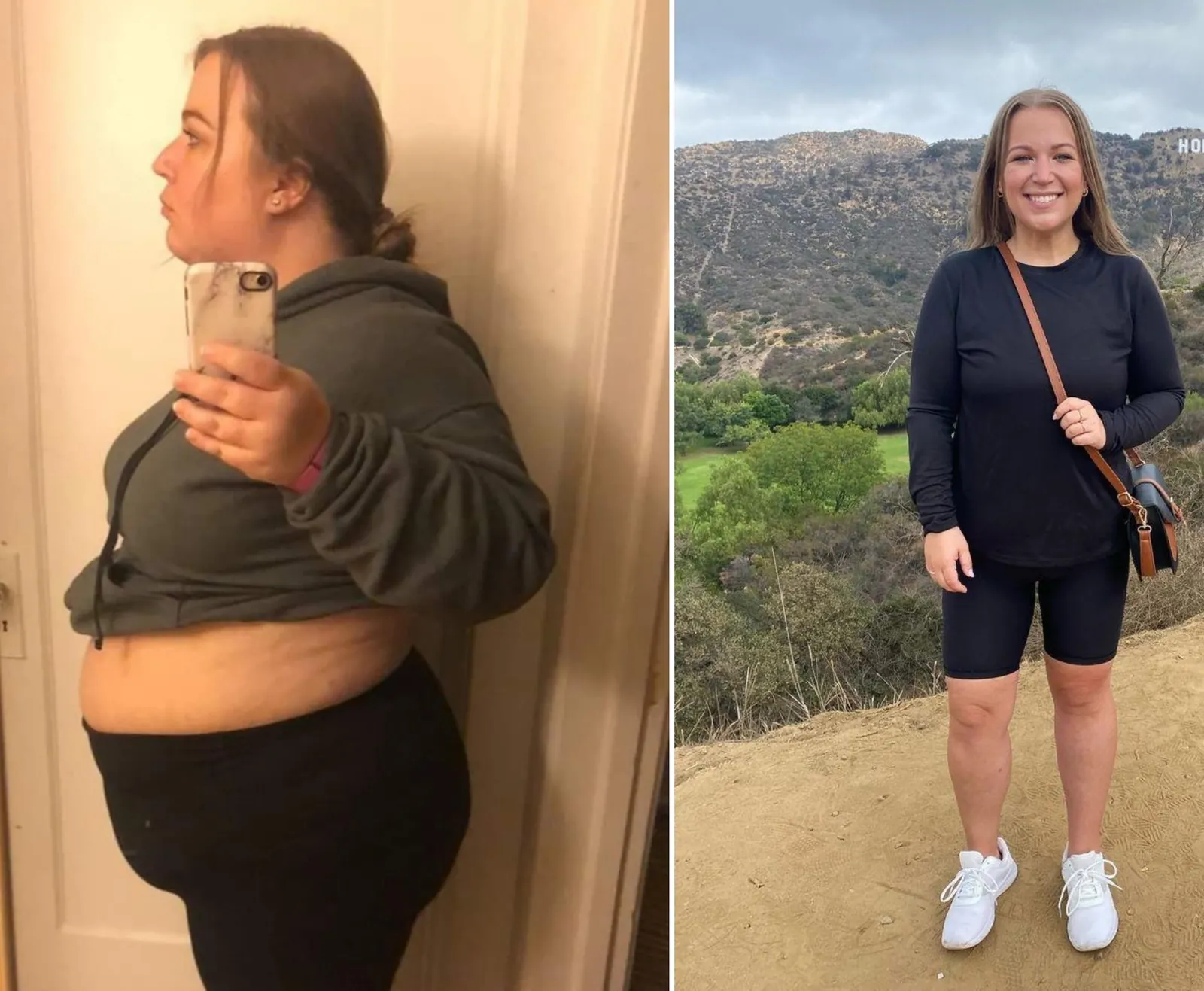 NEXA Retatrutide before and after weight loss result 8 (-24 kg · 100 days)